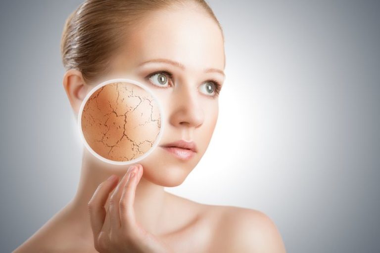 Pelle secca, una crema fai da te per combatterla