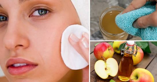 Come eliminare le rughe per sempre con l’aceto di mele