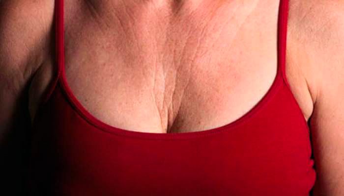 Grazie a questo rimedio naturale eliminerai le rughe sul collo e sul seno
